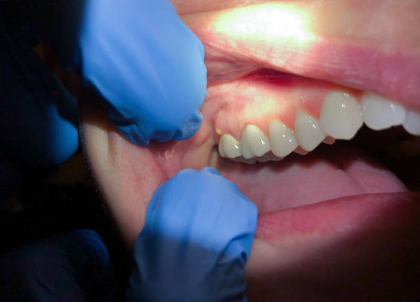 Best Weekend Emergency Dentist in Lake Forest Park, WA