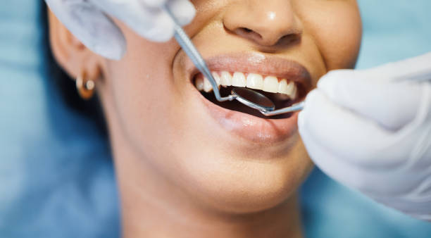 Best Emergency Dental Extractions in Lake Forest Park, WA